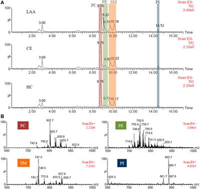 Screening of Phospholipids in Plasma of Large-Artery Atherosclerotic and Cardioembolic Stroke Patients With Hydrophilic Interaction Chromatography-Mass Spectrometry